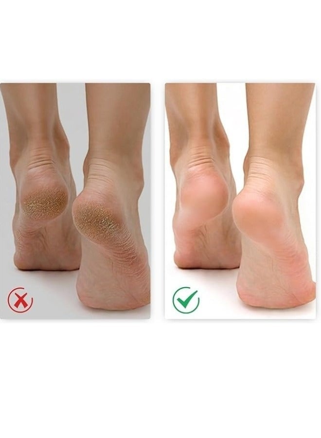 هابي هوم جهاز تقشير القدم الكهربائي - 2 رؤوس، شحن USB، لإزالة الجلد الميت وتنعيم القدمين - Image 5